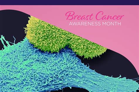 Metastatic Breast Cancer Cancer Therapy Advisor