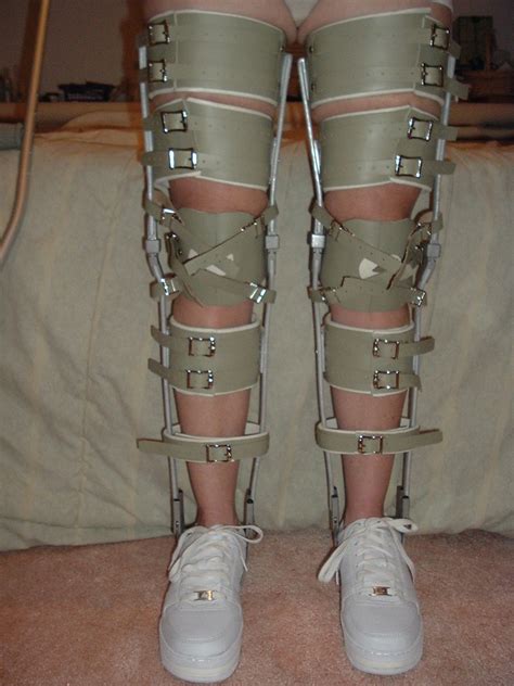 Smoked Elk Kafo Leg Braces Front View Not Much Skin Expose… Flickr