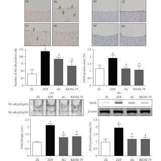 The effects of KIOM 79 treatment on activation of NF κB and iNOS in the