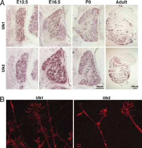 Expression And Localization Of Ulk And Ulk In Mouse Sensory Neurons