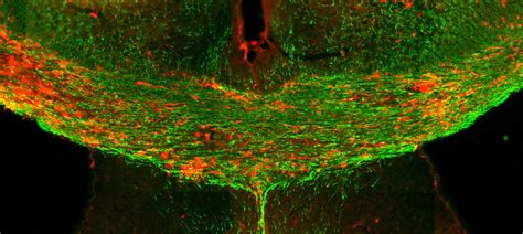 Locating Cells Linked To Multiple Sclerosis Elife Science Digests Elife