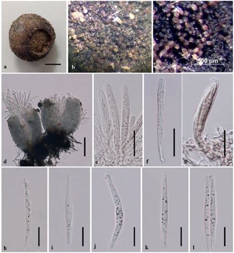 Pseudohelicomyces Quercus Mflu Holotype A The Host Seed B