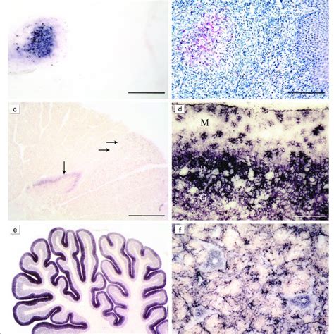 Prp Sc Distribution In The Brain Of Atypical Nor Scrapie Brain