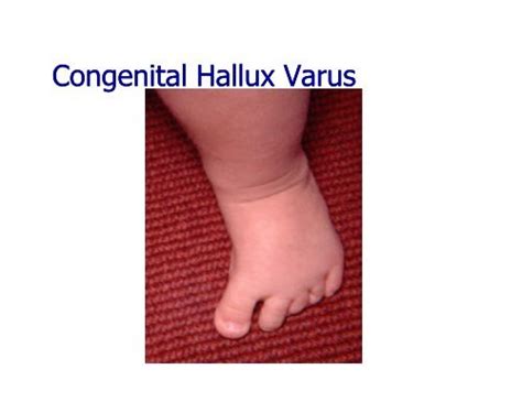 Congenital