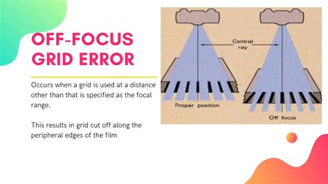 Grids Radiology Youtube