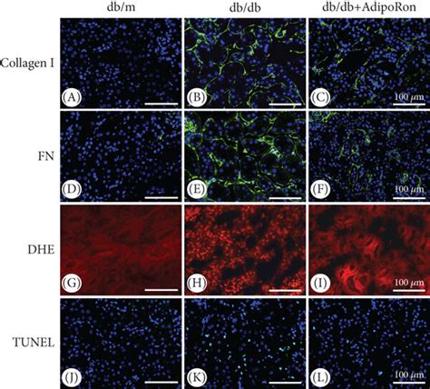 Effects Of Adiporon On Inflammation Apoptosis And Fibrosis In The