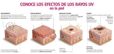 Este Verano Cuidado Con Las Quemaduras Solares Fernando Santa