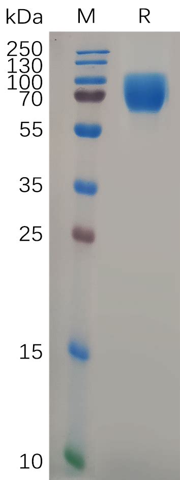 Human GHR Protein hFc Tag 专注肿瘤免疫