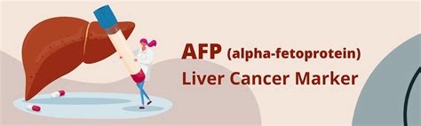 AFP - Liver Cancer Marker – Beacon Health Screening Centre