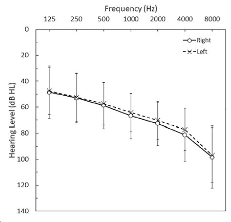 Mean ± Sd Air Conduction Pure Tone Thresholds For The Right And Left Download Scientific