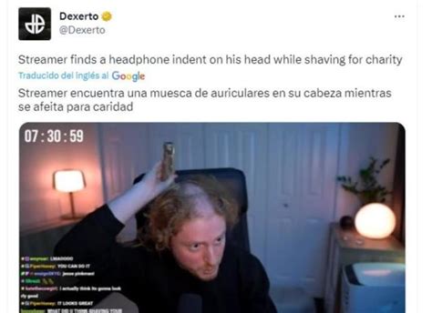 Streamer En TWITCH Se Rasura La Cabeza En Vivo Y Se Encuentra Hendidura