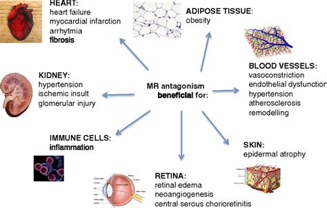 Emerging Roles Of The Mineralocorticoid Receptor In Pathology Toward