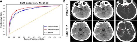 Deep Learning Based Software To Identify Large Vessel Occlusion On