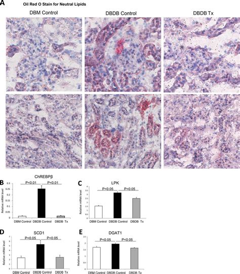 Sglt Protein Expression Is Increased In Human Diabetic Nephropathy