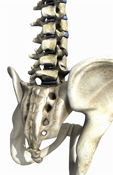 Lumbosacral Angle And Spinal Curves