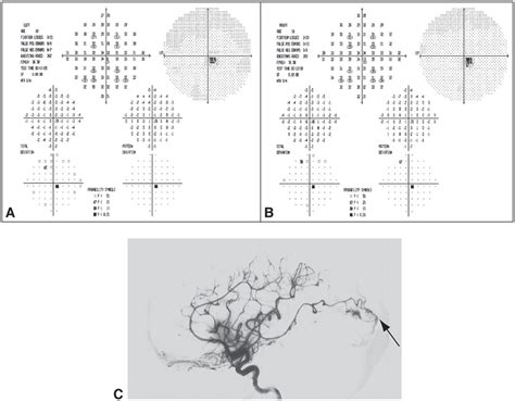 Chapter 4 The Patient With Decreased Vision Classification And