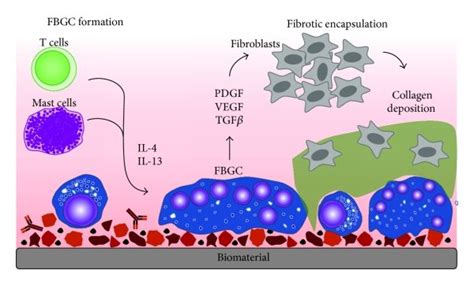 Foreign Body Response To Biomaterials The Foreign Body Response Is An Download Scientific