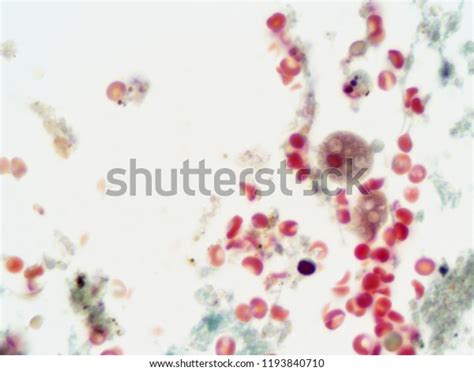 Entamoeba Histolytica 1000x Magnification Goldners Trichrome Stock