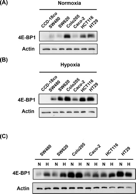 Compare 4e Bp1 Expression In Normal And Colorectal Cancer Cells Under Download Scientific