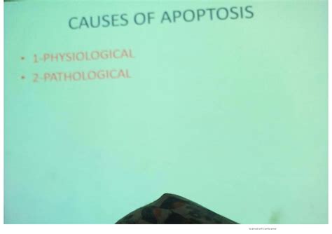 Solution Apoptosis Necrosis Notes From Robbins Basic Pathology Medical