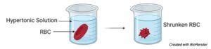 Hypertonic Solution : Definition and Examples