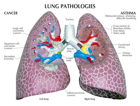 Lung Cross Section Labeled