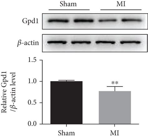 Mir P Affects Cardiac Fibrosis By Targeting Gpd A Three