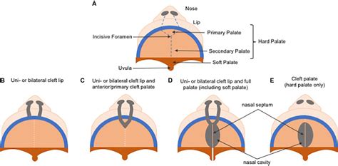 Frontiers Extracellular Matrix Composition And Remodeling Current Perspectives On Secondary