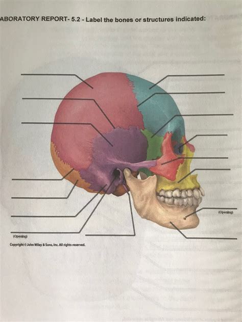 Lateral Skull Diagram Quizlet