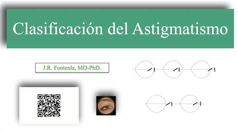 Clasificaci N Del Astigmatismo Youtube