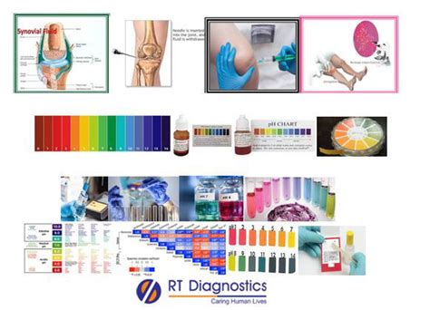 PH Synovial Fluid RT Diagnostics