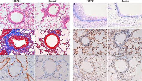 Histology And Immunohistochemistry Of Lung Tissues A He Staining B