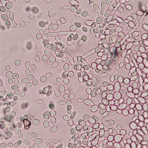 Yeast Cells Under Microscope 400x Micropedia