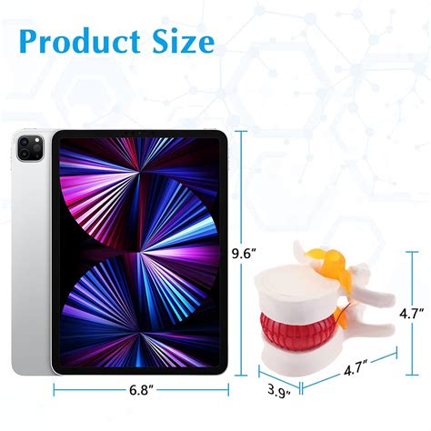 Buy Skumod Lumbar Disc Herniation Model Ideal For Teaching And Learning