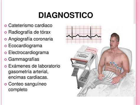 Shock Cardiogenico