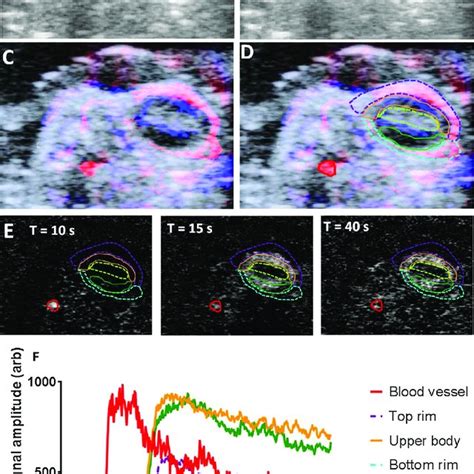 Pdf Value Of Combining Dynamic Contrast Enhanced Ultrasound And