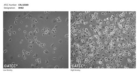 Dh82细胞atcc Crl 10389细胞 狗肾恶性组织细胞增生症细胞株购买价格、培养基、培养条件、细胞图片、特征等基本信息生物风