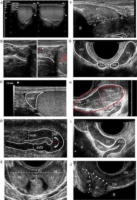 Normal Color Doppler Ultrasound Cdus Features Of The Organs Of The