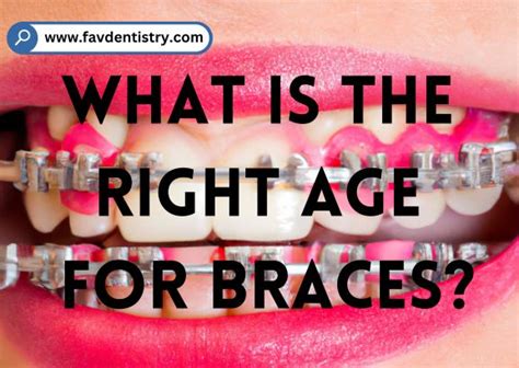 What Is The Right Age For Braces Favourite Dentistry