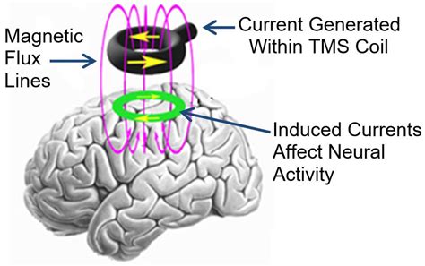 Jcm Free Full Text Unresolved Issues Associated With Transcranial