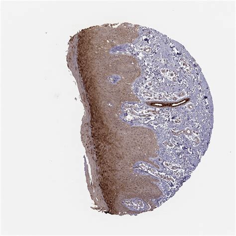 Tissue Expression Of Apc Staining In Skin The Human Protein Atlas