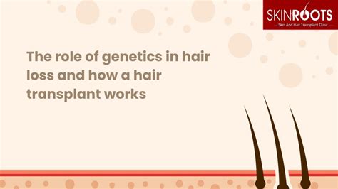 PPT The Role Of Genetics In Hair Loss And How A Hair Transplant Works