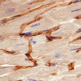 Mouse S1P1 EDG 1 Antibody MAB7089 By R D Systems Part Of Bio Techne