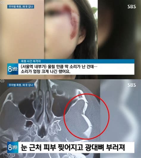 ‘서울역 묻지마 폭행 30대 남성 용의자 자택서 검거종합 서울신문