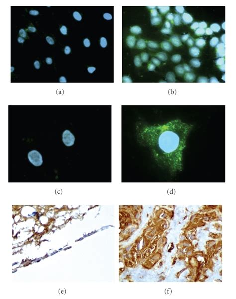 Indirect Immunofluorescence Staining And Immunohistochemistry Were