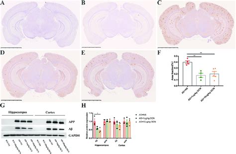 Ocn Reduced The A Burden In The Hippocampus And Cortex Of Ad Mice A E