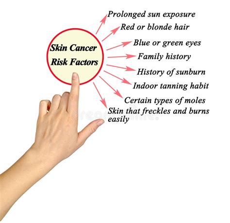 Skin Cancer Risk Factors Stock Image Image Of Pointing 291288919