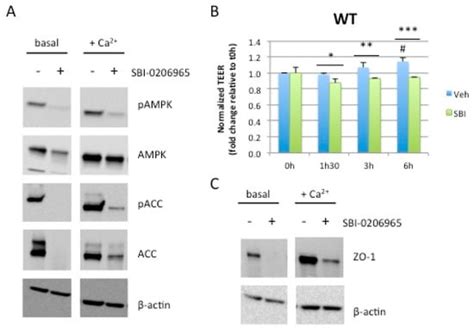 Ijms Free Full Text Ampk Activation Promotes Tight Junction