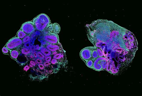 Organoids II Cell Press