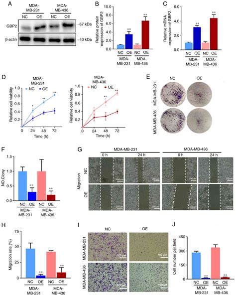 GBP2 Enhances Paclitaxel Sensitivity In Triplenegative Breast Cancer